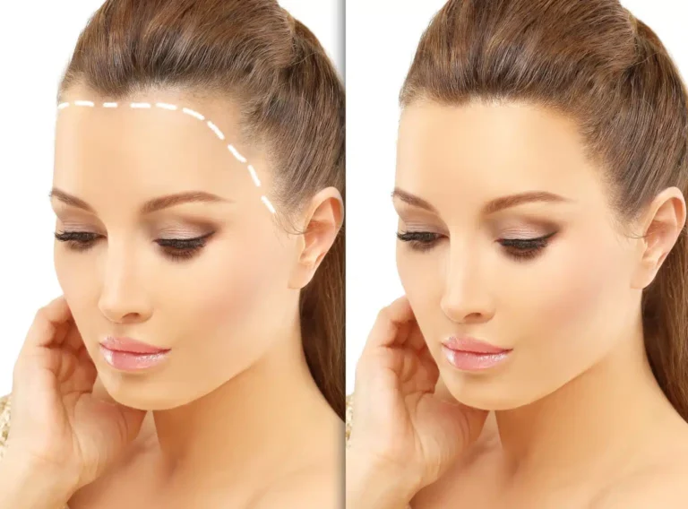 Flymeditrust hair (2)