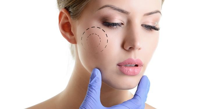 bisektomi-yanak-estetigi