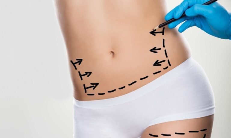 karın-yağ-aldırma-scaled